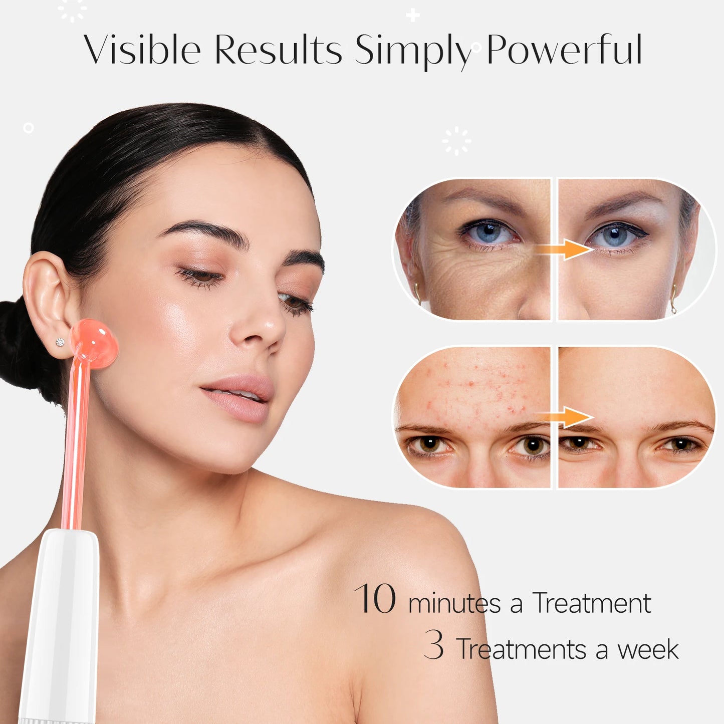 EternaSkin LumiSpark™ High-Frequency Facial Wand